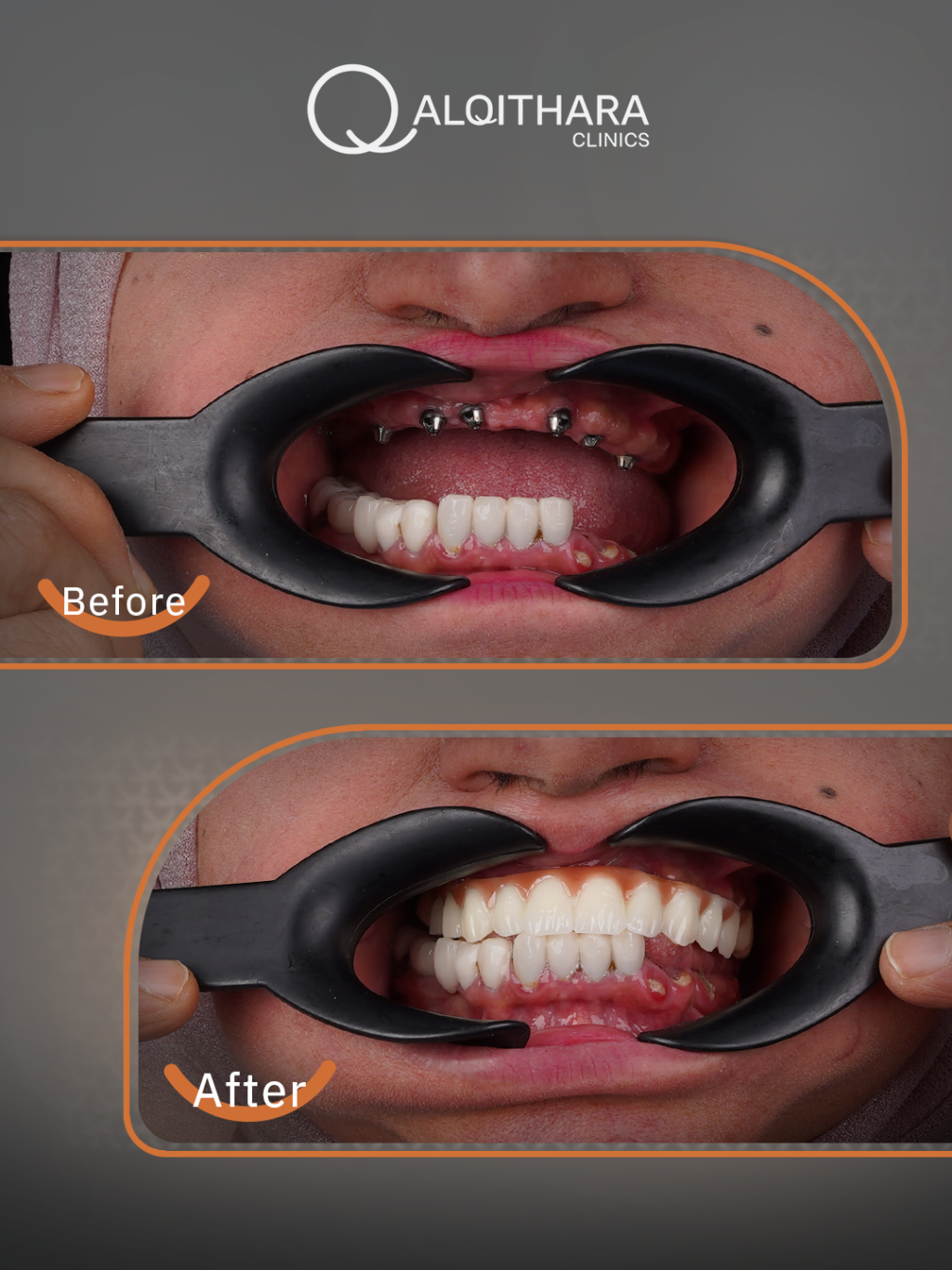 صورة توضيحية لخدمة القيثارة