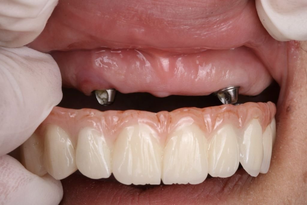 صورة توضيحية لخدمة القيثارة