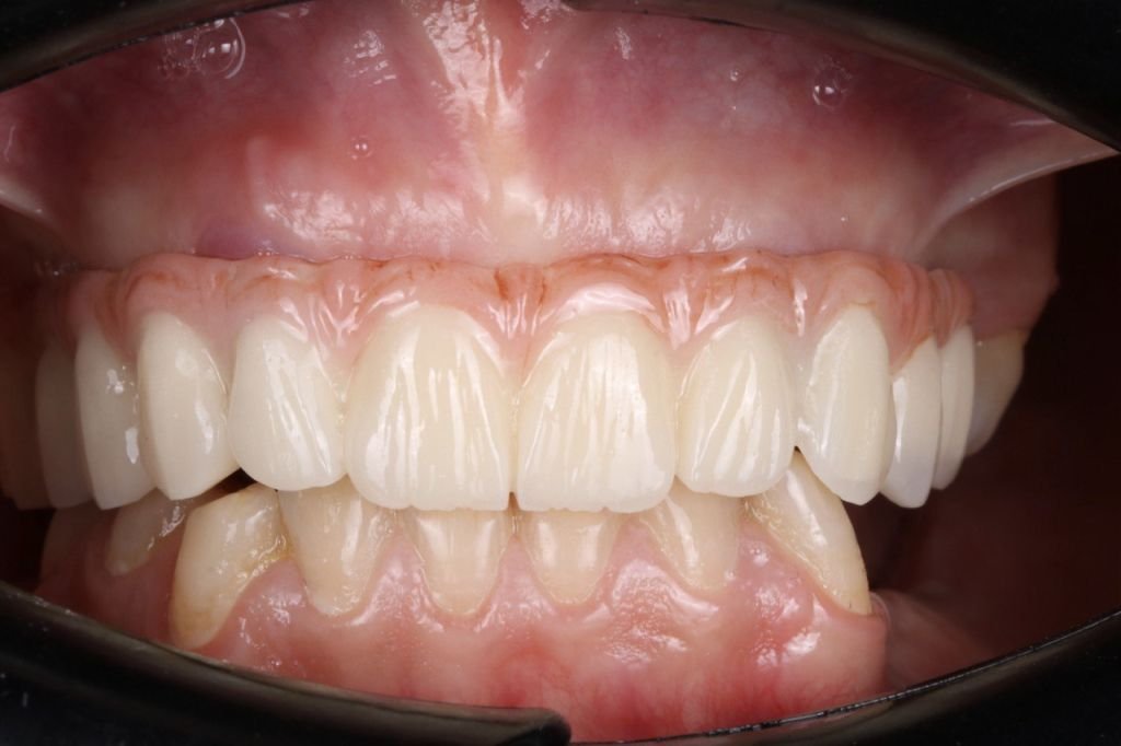 صورة توضيحية لخدمة القيثارة